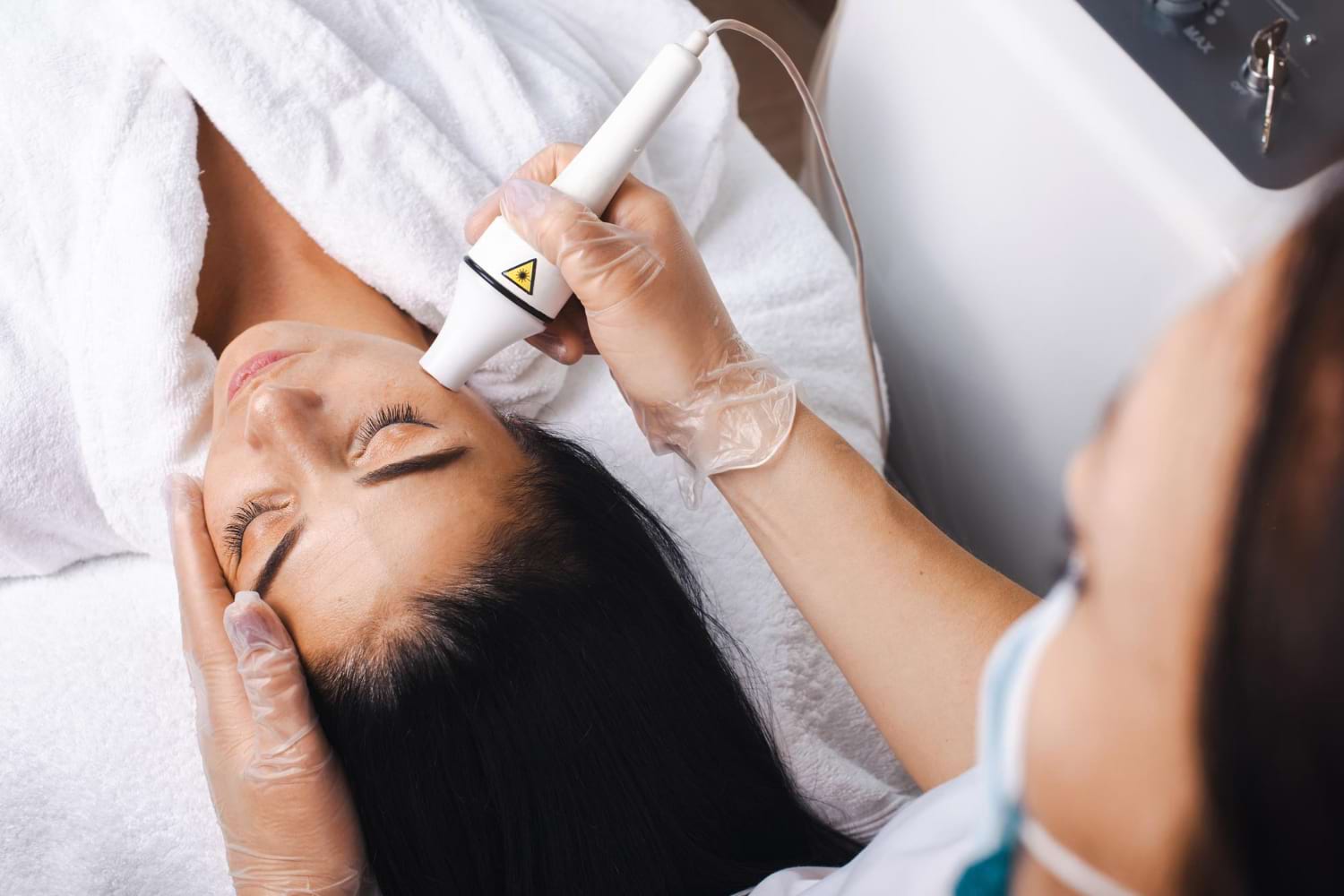 radiofrekwencja mikroigłowa